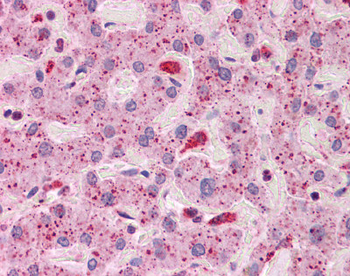 TLR2 Rabbit Polyclonal Antibody