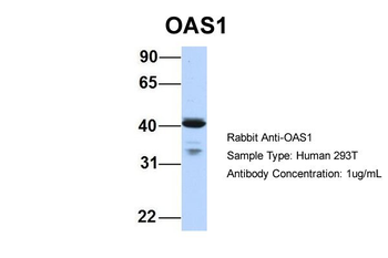 OAS1 Rabbit Polyclonal Antibody