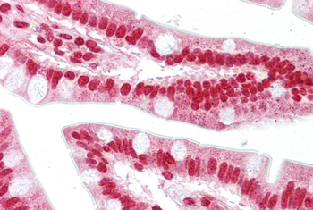 OAS1 Rabbit Polyclonal Antibody
