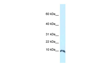 Sumo1 Rabbit Polyclonal Antibody