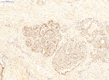 YWHAE Rabbit Polyclonal Antibody