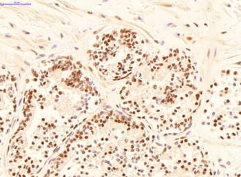 YWHAE Rabbit Polyclonal Antibody