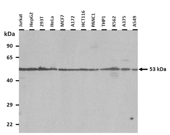MAP3K8 Rabbit Polyclonal Antibody