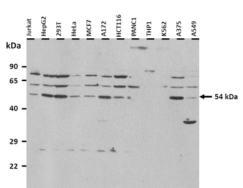 HTR2B Rabbit Polyclonal Antibody