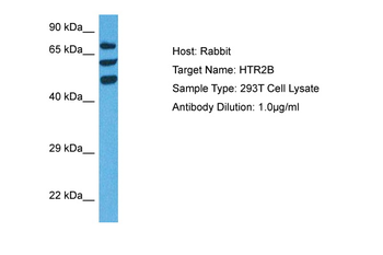 HTR2B Rabbit Polyclonal Antibody