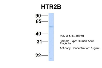 HTR2B Rabbit Polyclonal Antibody