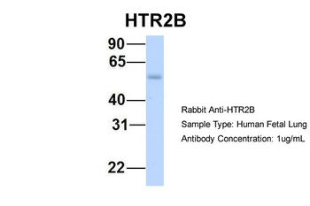 HTR2B Rabbit Polyclonal Antibody