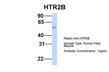 HTR2B Rabbit Polyclonal Antibody