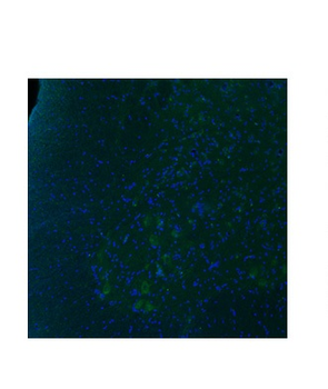 HTR2B Rabbit Polyclonal Antibody