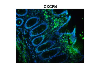 CXCR4 Rabbit Polyclonal Antibody