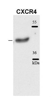 CXCR4 Rabbit Polyclonal Antibody