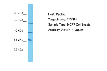 CXCR4 Rabbit Polyclonal Antibody