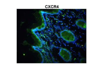 CXCR4 Rabbit Polyclonal Antibody
