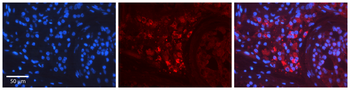 RET Rabbit Polyclonal Antibody