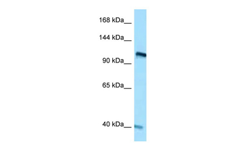 RET Rabbit Polyclonal Antibody