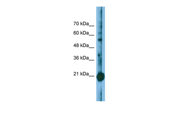 CBFB Rabbit Polyclonal Antibody