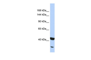 NFKB2 Rabbit Polyclonal Antibody