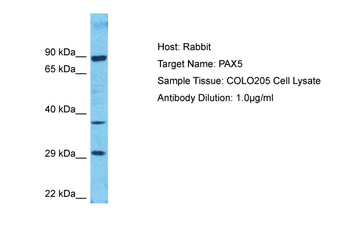 PAX5 Rabbit Polyclonal Antibody