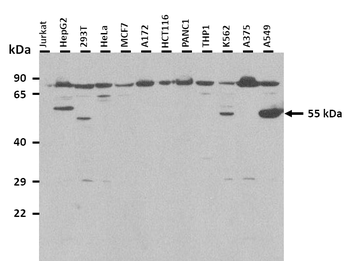 Pax7 Rabbit Polyclonal Antibody