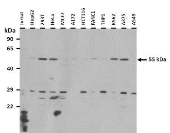 Pax7 Rabbit Polyclonal Antibody
