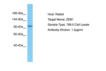 ZEB1 Rabbit Polyclonal Antibody