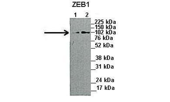 ZEB1 Rabbit Polyclonal Antibody