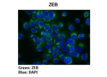 ZEB1 Rabbit Polyclonal Antibody