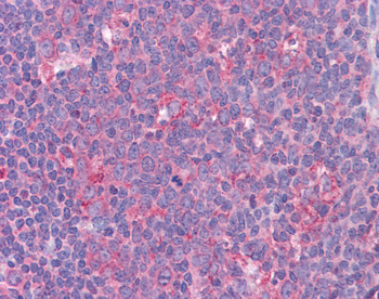 STAT6 Rabbit Polyclonal Antibody