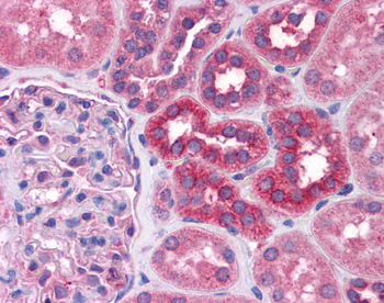 STAT6 Rabbit Polyclonal Antibody