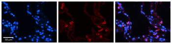 STAT6 Rabbit Polyclonal Antibody