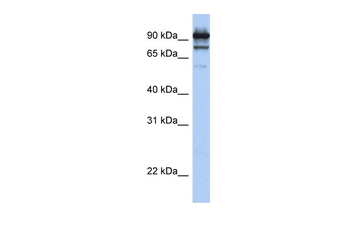 STAT6 Rabbit Polyclonal Antibody