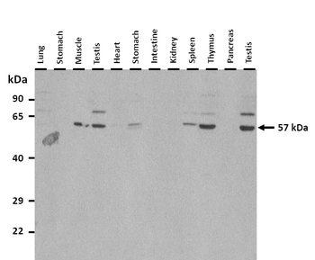 Runx2 Rabbit Polyclonal Antibody