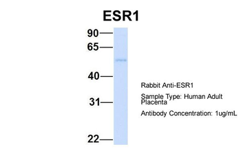 ESR1 Rabbit Polyclonal Antibody