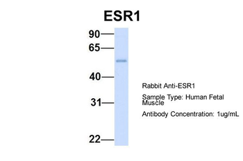 ESR1 Rabbit Polyclonal Antibody