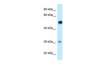 HSF2 Rabbit Polyclonal Antibody