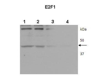 E2F1 Rabbit Polyclonal Antibody