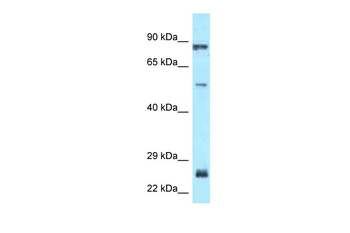 E2F1 Rabbit Polyclonal Antibody