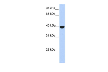 ELK1 Rabbit Polyclonal Antibody