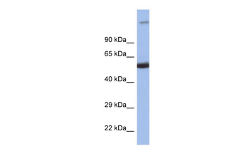 IRF8 Rabbit Polyclonal Antibody