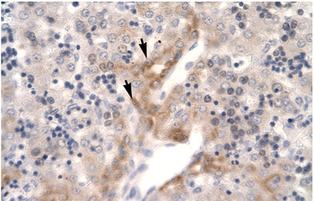 FOSL2 Rabbit Polyclonal Antibody