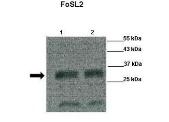 FOSL2 Rabbit Polyclonal Antibody