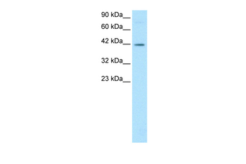 FOSL2 Rabbit Polyclonal Antibody
