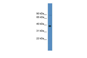 FOSL2 Rabbit Polyclonal Antibody