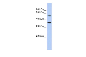 CDK7 Rabbit Polyclonal Antibody