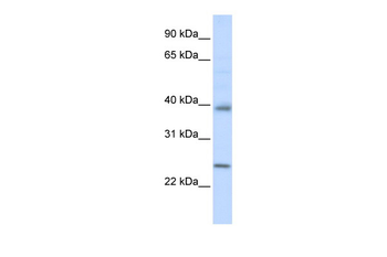 CLDN7 Rabbit Polyclonal Antibody