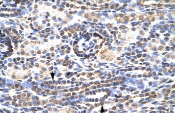 KLF9 Rabbit Polyclonal Antibody
