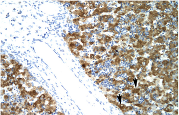NFYA Rabbit Polyclonal Antibody
