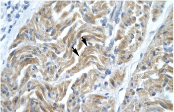 NFYA Rabbit Polyclonal Antibody