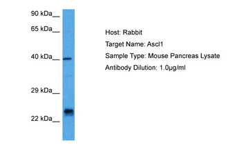 ASCL1 Rabbit Polyclonal Antibody