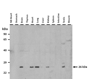 MXI1 Rabbit Polyclonal Antibody
